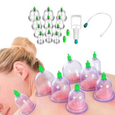 Vacuum Cupping Therapy Set – Muscle Pain Relief, Circulation & Deep Relaxation at Home