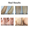 IPL Laser Hair Remover – 999,990 Flashes, 5 Levels, LCD Display for Women & Men