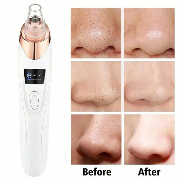 Electric Blackhead Remover Vacuum – Deep Pore Cleansing Facial Suction for Clear, Smooth Skin