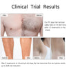 IPL Laser Hair Remover – 999,990 Flashes, 5 Levels, LCD Display for Women & Men