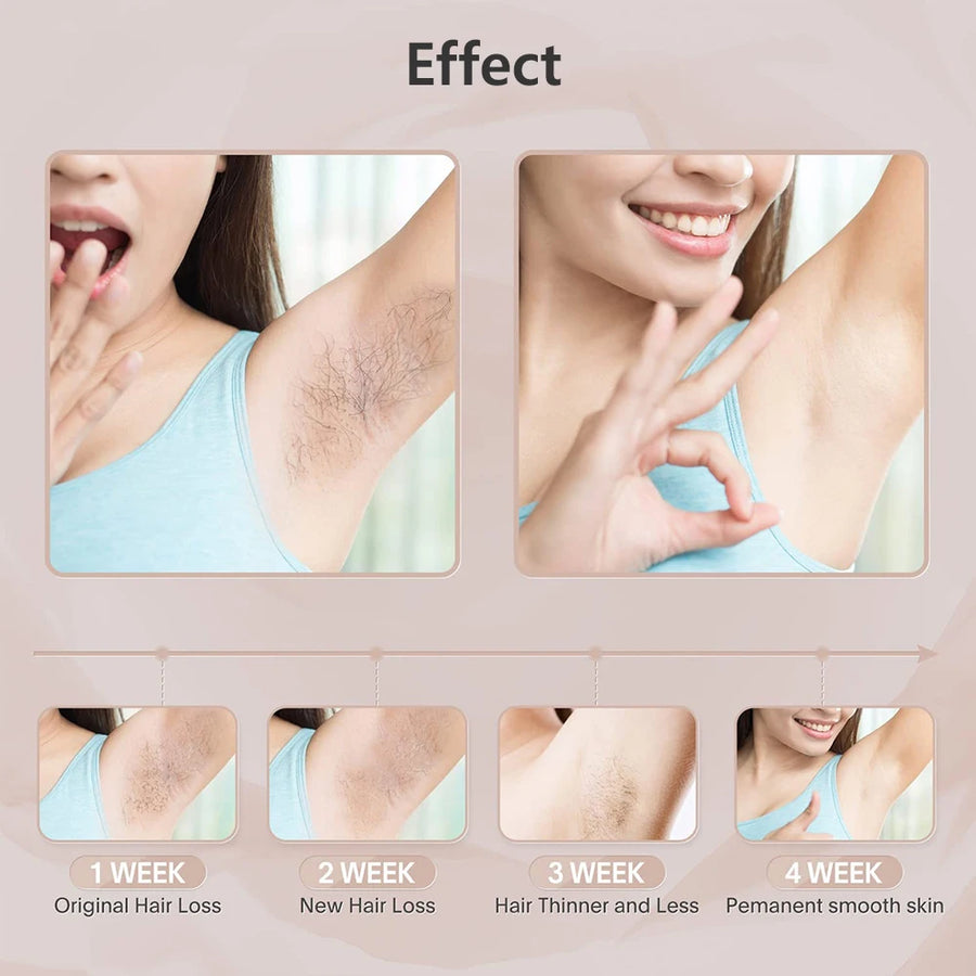 IPL Laser Hair Remover – 999,990 Flashes, 5 Levels, LCD Display for Women & Men