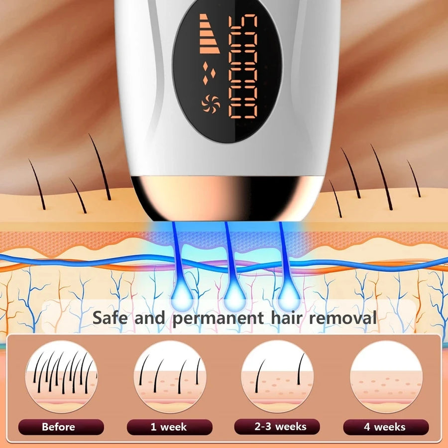 IPL Laser Hair Remover – 999,990 Flashes, 5 Levels, LCD Display for Women & Men